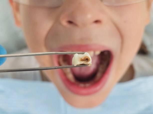 Best Knocked-Out Tooth Emergency  in Whetstone, AZ