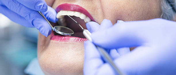 Emergency Dental Filling Replacement in AZ